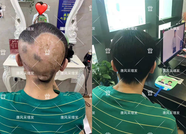 定做真人發(fā)假發(fā) \