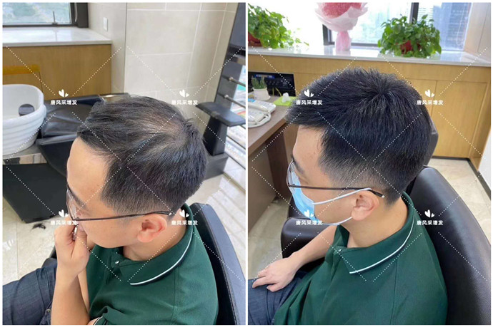 男士短假發(fā) \