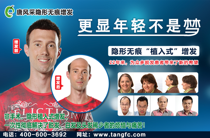 假發(fā)無痕發(fā)際線 \