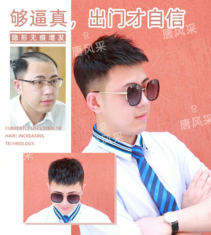 假發(fā)無痕發(fā)際線 \