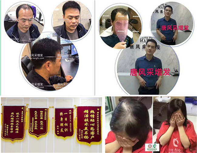 男士定做假發(fā) \