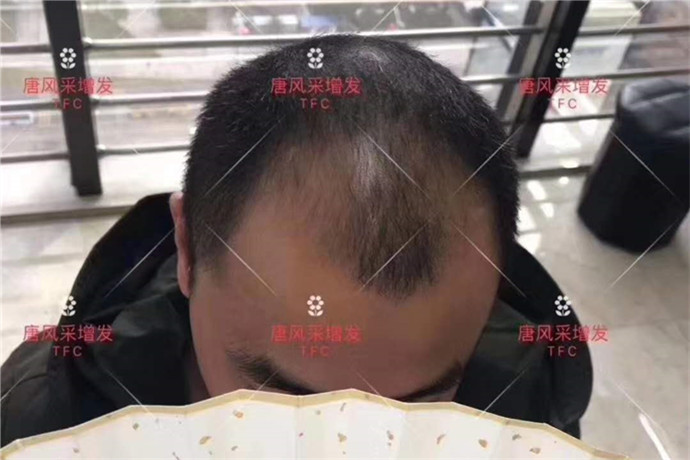 男士定做假發(fā) \
