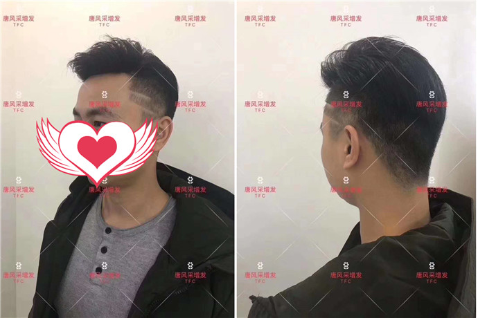 定做假發(fā) \