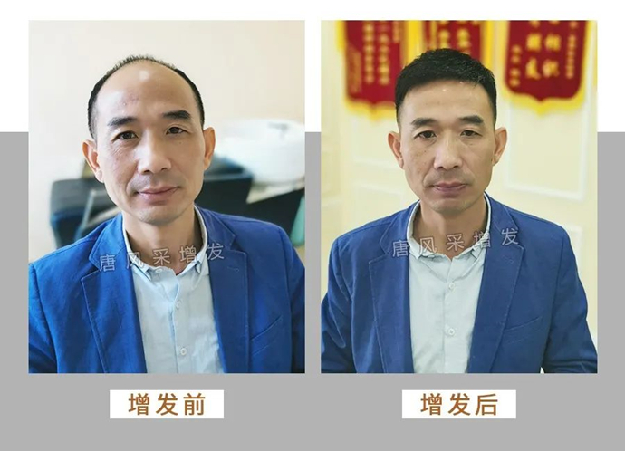 唐風采增發(fā) \