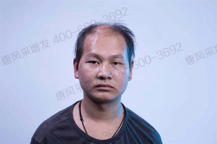 要不要做隱形增發(fā) \
