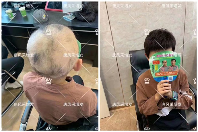 要不要做隱形增發(fā) \