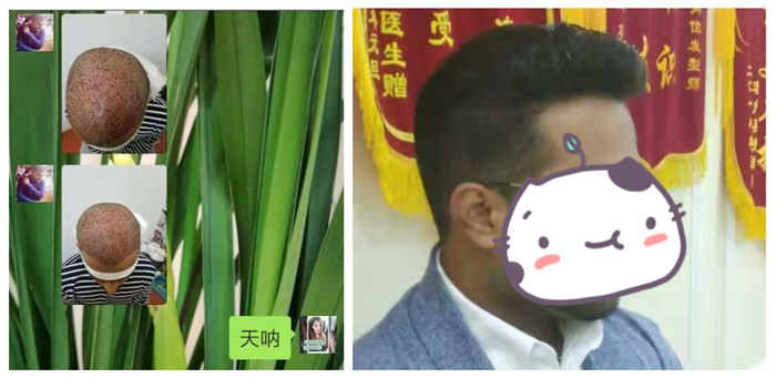 要不要做隱形增發(fā) \