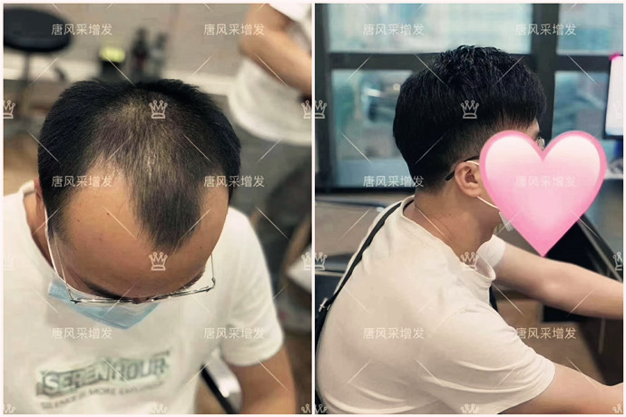 梳理假發(fā) \