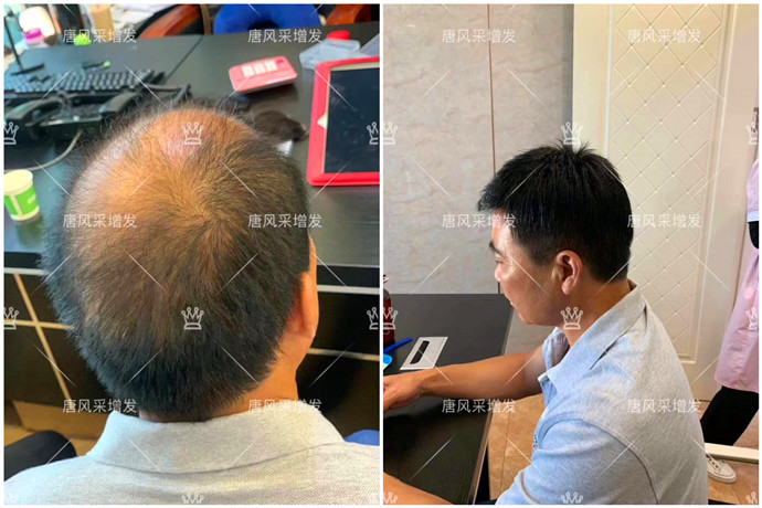 補(bǔ)發(fā)增發(fā) \