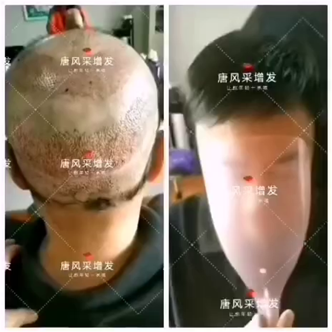假發(fā)經(jīng)濟(jì) \