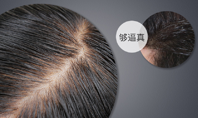 局部頭頂補(bǔ)發(fā) \