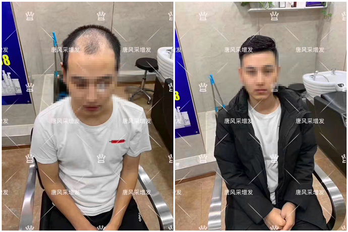 真頭發(fā)假發(fā)價格 \