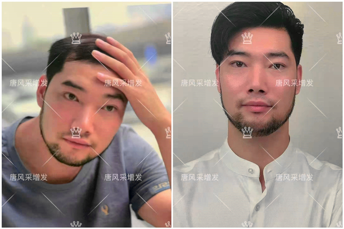 定制發(fā)塊 \