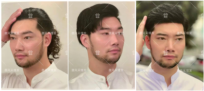 定制發(fā)塊 \