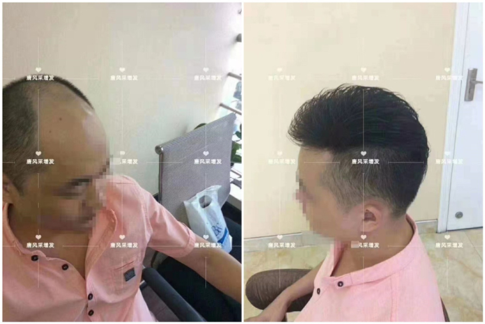 男士高級(jí)假發(fā) \