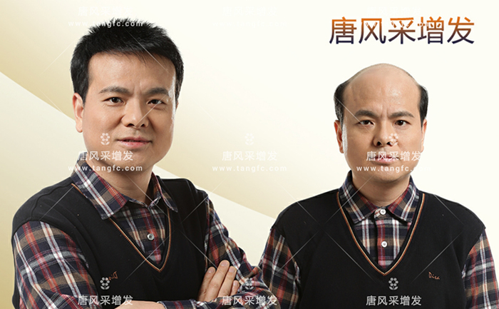 專(zhuān)業(yè)男士假發(fā) \