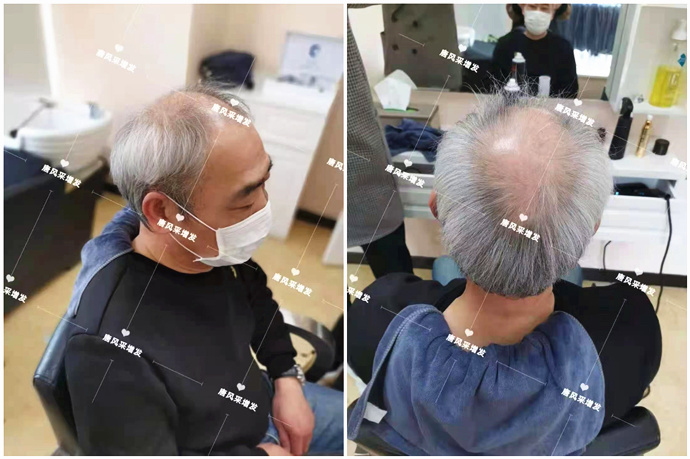 專(zhuān)業(yè)男士假發(fā) \