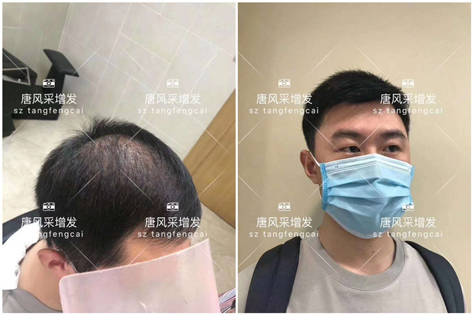 補發(fā)片哪個牌子好 \