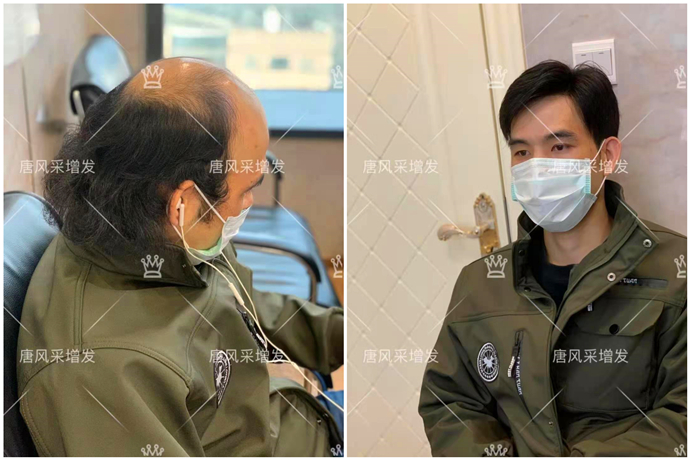 補發(fā)片哪個牌子好 \