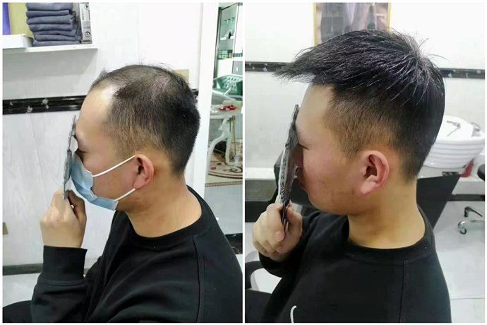 戴假發(fā)會(huì)很麻煩嗎 \