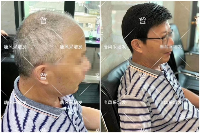 男士短假發(fā)價格 \