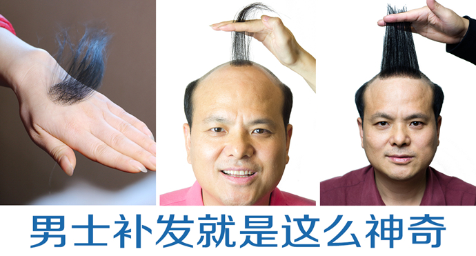 私人訂制無痕補發(fā) \