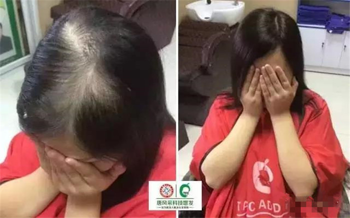 假發(fā)定制多少錢(qián) \