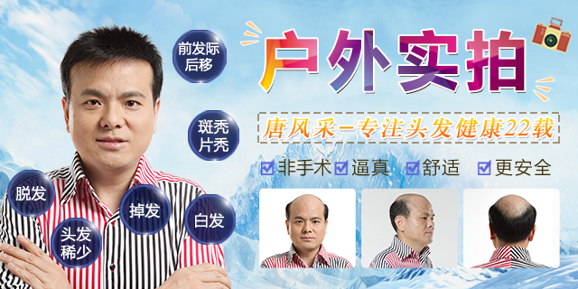 翻蓋式假發(fā) \