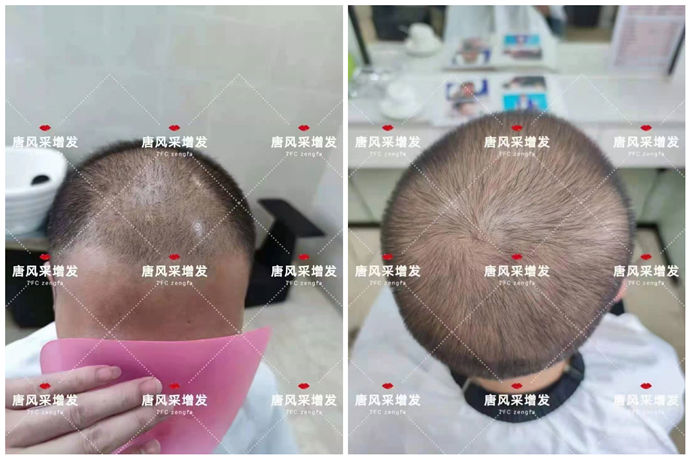 精品假發(fā) \