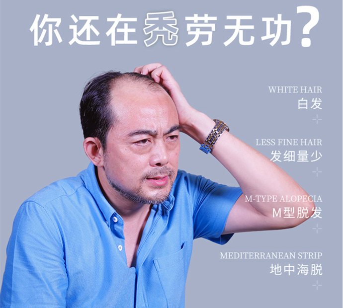 禿頂危機(jī) \