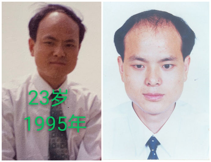 禿頂危機(jī) \