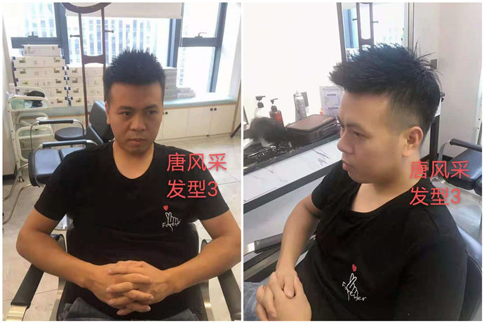 隱形假發(fā) \