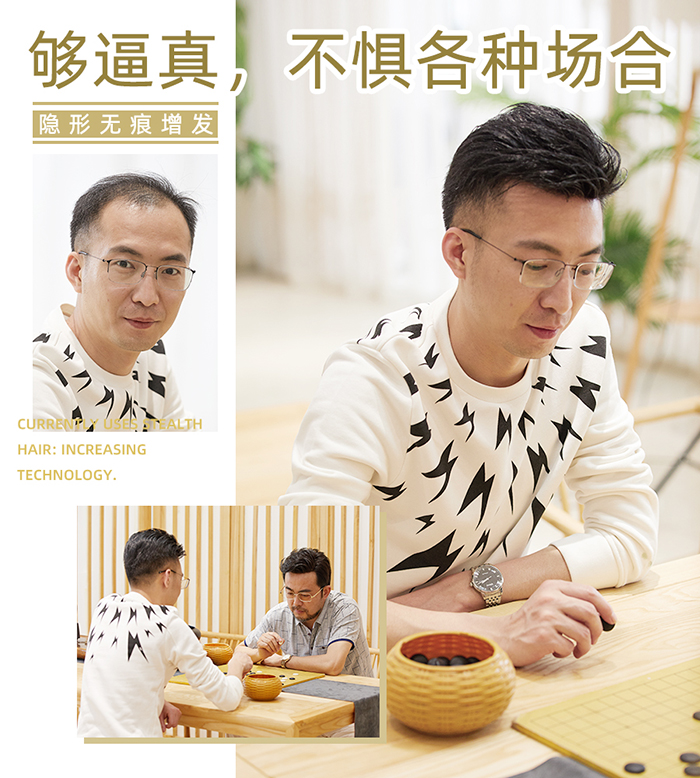 男士增發(fā)--后背頭案例 男士增發(fā)--后背頭案例