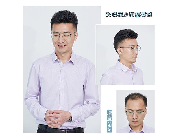 隱形增發(fā)對(duì)比照 \