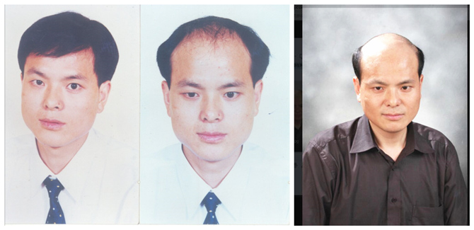 隱形增發(fā)對(duì)比照 \