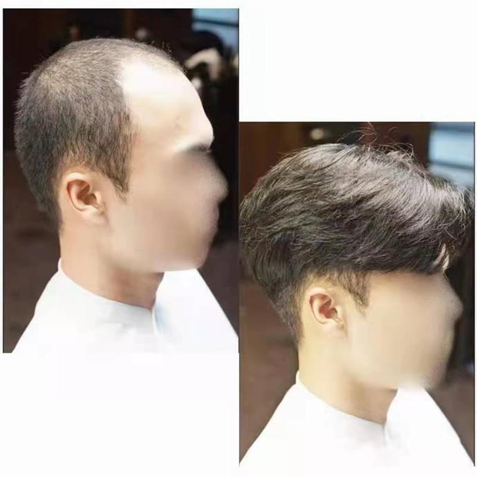 隱形增發(fā)對(duì)比照 \