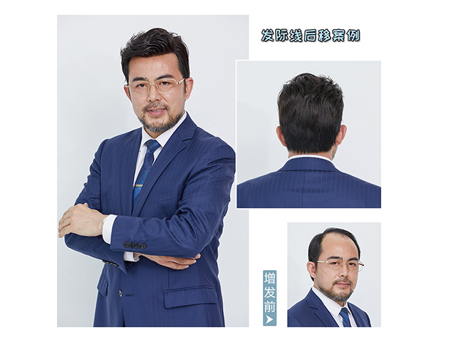 隱形增發(fā)對(duì)比照 \