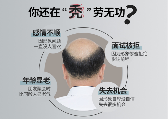 男士頭頂補(bǔ)發(fā) \