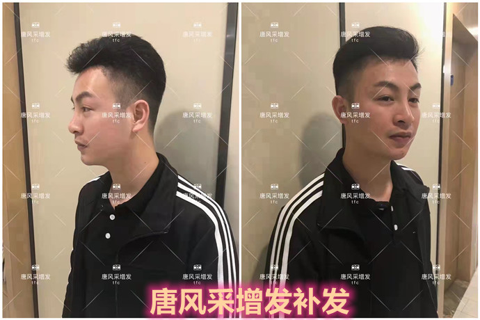 補發(fā)效果 \