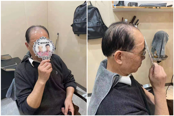 男士隱形補發(fā)哪家好 \