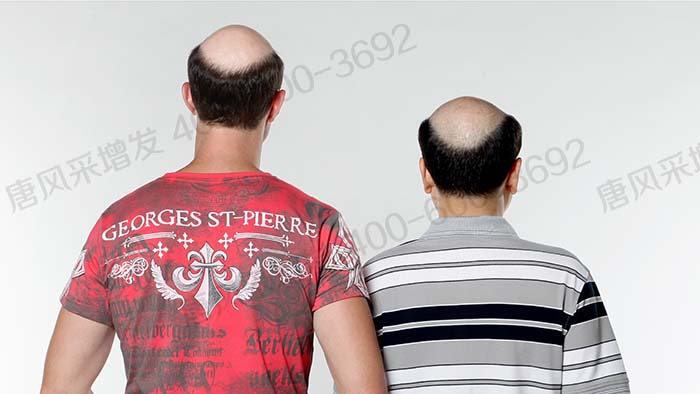 男士假發(fā)定制要多久時間 \