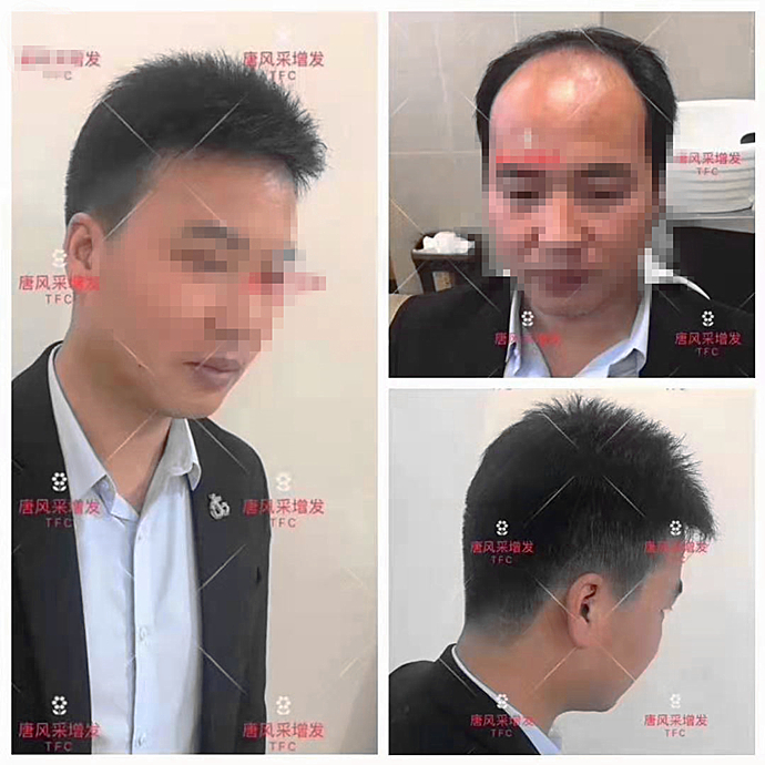 男士假發(fā)定制要多久時間 \