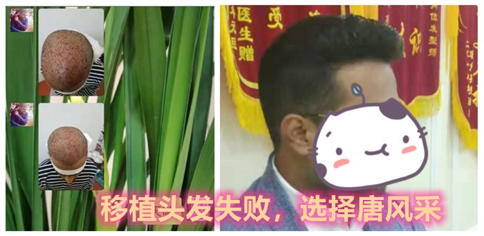 假發(fā) \
