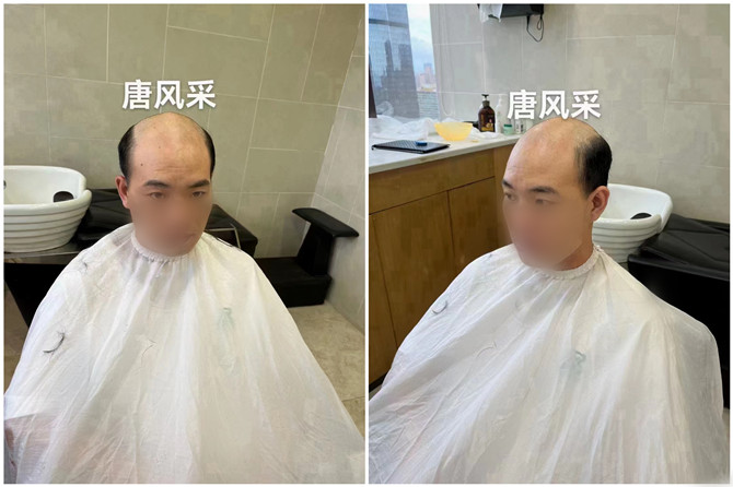 男士增發(fā)補發(fā)實體店 \