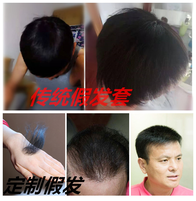 男假發(fā)套 \