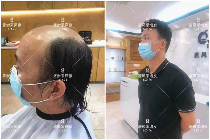 仿真男士補發(fā) \