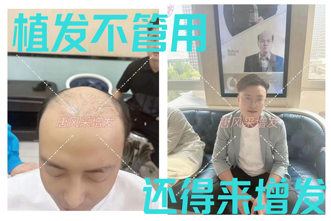 整容式逆襲 \