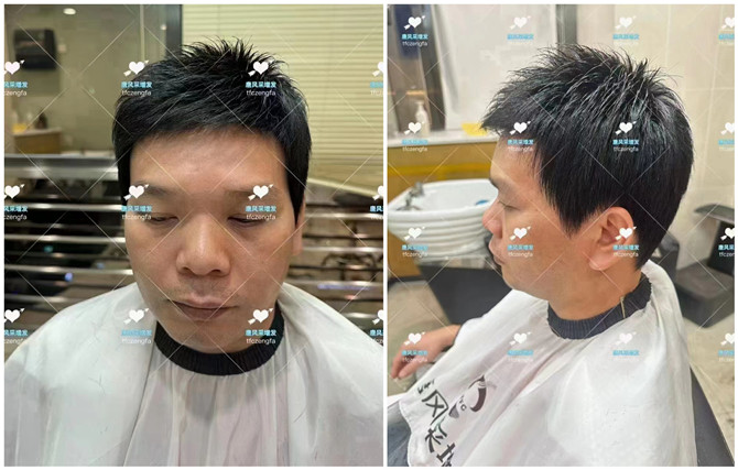 隱形補發(fā)塊 \