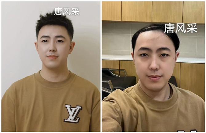 隱形補發(fā)塊 官方二維碼 \