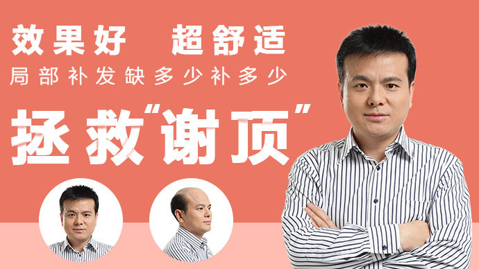 北京朝陽哪里有賣假發(fā)的 \
